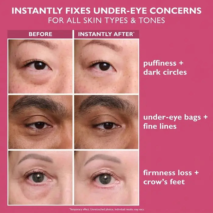 Instant Eye Tightener (20 ml)